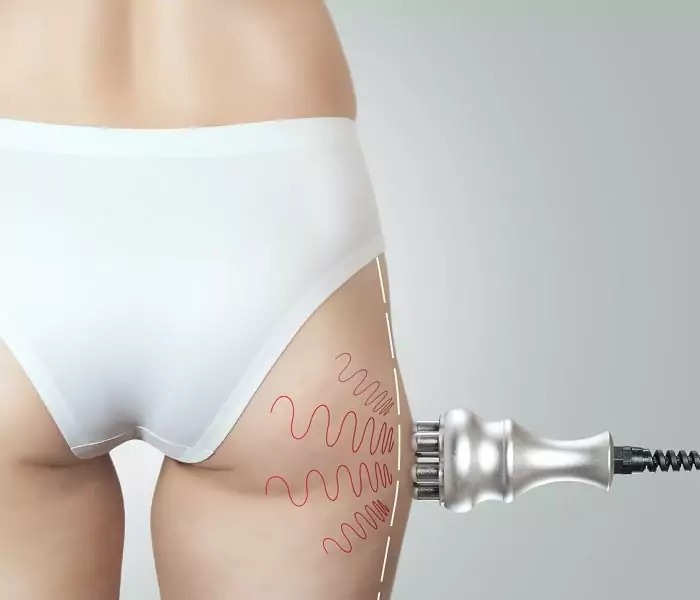 Radio Frequency Treatments